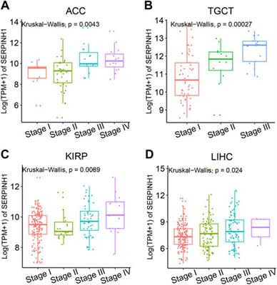 Prognostic and immunological role of SERPINH1 in pan-cancer